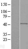 Seladin 1 (DHCR24) Human Over-expression Lysate