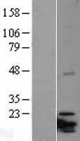 ITGB3BP Human Over-expression Lysate