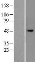 NR2E3 Human Over-expression Lysate