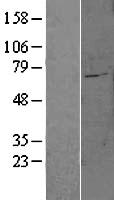 SLC27A6 Human Over-expression Lysate