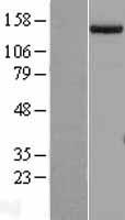 SETDB1 Human Over-expression Lysate