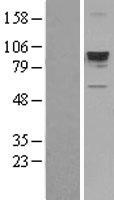 TLK1 Human Over-expression Lysate