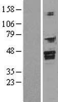 FOXI1 Human Over-expression Lysate