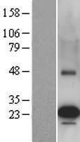 PEAMT (PEMT) Human Over-expression Lysate