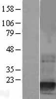 Destrin (DSTN) Human Over-expression Lysate