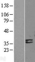 Deoxyribonuclease I like 1 (DNASE1L1) Human Over-expression Lysate