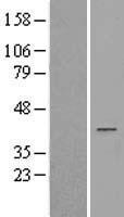 AKR1D1 Human Over-expression Lysate