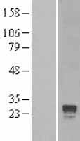 RGS4 Human Over-expression Lysate