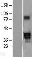 PPT2 Human Over-expression Lysate