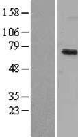 DYRK1B Human Over-expression Lysate