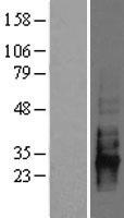 CD83 Human Over-expression Lysate