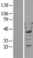 Tryptophanyl tRNA synthetase (WARS) Human Over-expression Lysate