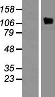 PYK2 (PTK2B) Human Over-expression Lysate