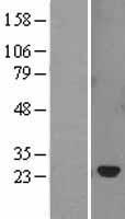 SOCS2 Human Over-expression Lysate