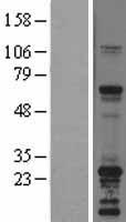 SNAP23 Human Over-expression Lysate