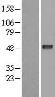 EED Human Over-expression Lysate
