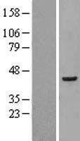 EIF3S3 (EIF3H) Human Over-expression Lysate