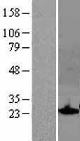 SOCS1 Human Over-expression Lysate