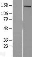 NCOA1 Human Over-expression Lysate