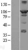 PPFIBP2 Human Over-expression Lysate