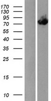 ACOX3 Human Over-expression Lysate