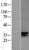 UCP3 Human Over-expression Lysate