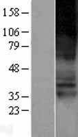 SLC22A4 Human Over-expression Lysate