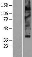 VMAT2 (SLC18A2) Human Over-expression Lysate