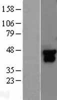 MEK4 (MAP2K4) Human Over-expression Lysate