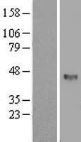 SFRP4 Human Over-expression Lysate