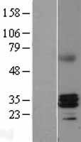 RNase H1 (RNASEH1) Human Over-expression Lysate