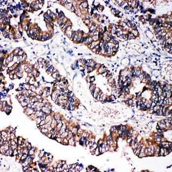 Caspase-3 (P10)/CASP3 Antibody