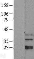 MAPK11 Human Over-expression Lysate