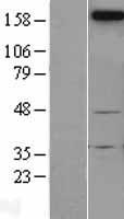 Neogenin (NEO1) Human Over-expression Lysate