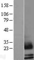 SCGB2A1 Human Over-expression Lysate