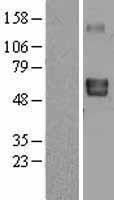LTBR Human Over-expression Lysate