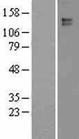 Leptin Receptor (LEPR) Human Over-expression Lysate