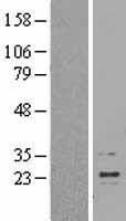 Interferon beta (IFNB1) Human Over-expression Lysate