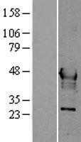 Hepsin (HPN) Human Over-expression Lysate