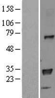 HLA-DPB1 Human Over-expression Lysate
