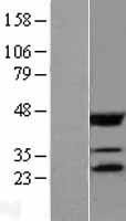 EIF4E Human Over-expression Lysate