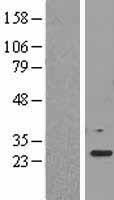 EEF1B2 Human Over-expression Lysate