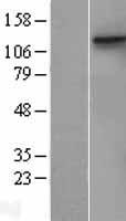 MCK10 (DDR1) Human Over-expression Lysate