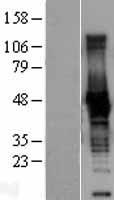Creatine kinase B type (CKB) Human Over-expression Lysate