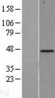 Biglycan (BGN) Human Over-expression Lysate