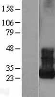 ARF5 Human Over-expression Lysate