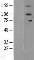 IL12RB2 Human Over-expression Lysate
