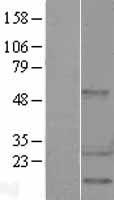 HSP27 (HSPB1) Human Over-expression Lysate