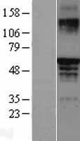 Estrogen Receptor beta (ESR2) Human Over-expression Lysate