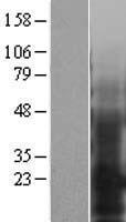 EMP3 Human Over-expression Lysate